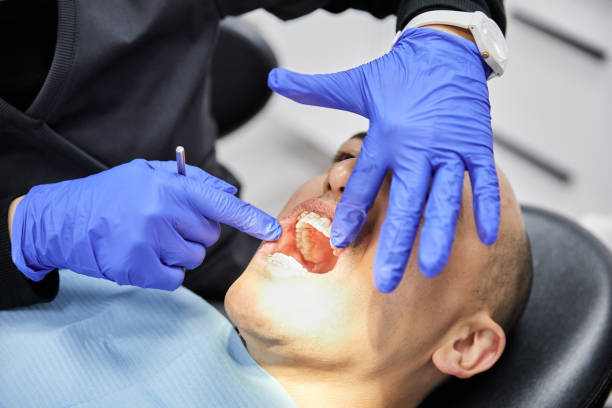 Best Emergency Treatment for Dental Infections or Abscesses in Upper Brookville, NY